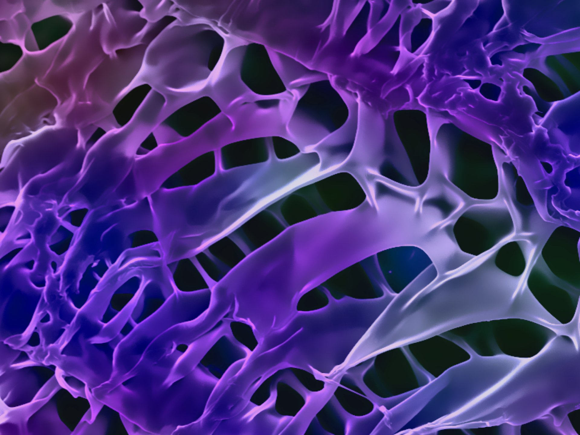 Scanning electron micrograph of a polymer layer degraded by a nanobiocatalyst