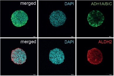 3D HepaRG were stained for ADH1A/B/C(green), ALDH2 (red), and counterstained with DAPI (blue). Scale bar representing 100 μm.